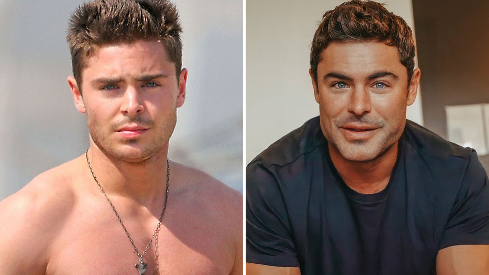 Zac Efron reapareció después escándalo por su rostro deformado - N Digital