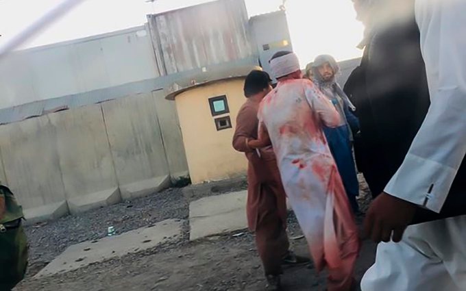 Este jueves se produjo una explosión en el aeropuerto internacional Hamid Karzai de Kabul, Afganistán, según dos funcionarios estadounidenses. Uno de los funcionarios dijo que hay heridos entre los afganos , pero no hay información aún sobre víctimas estadounidenses.