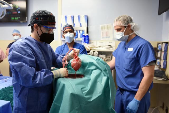 Cirujanos de EEUU trasplantan con éxito un corazón de cerdo a una persona