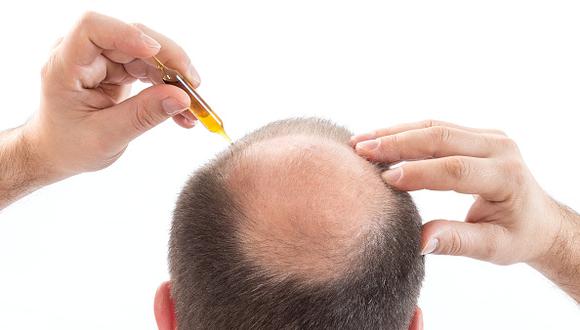EE.UU aprueba primera píldora para tratamiento de alopecia