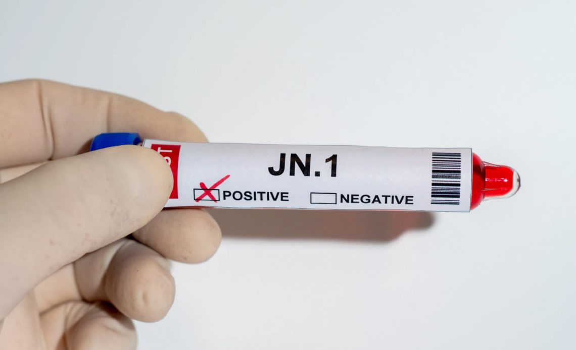 Sociedad Infectología llama a extremar medidas de prevención por virus JN.1